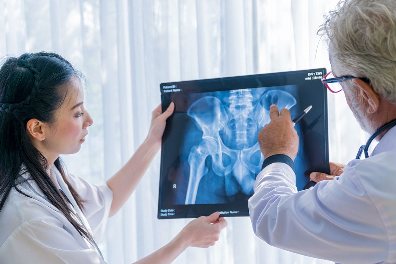 Espondiloartritis anquilosante